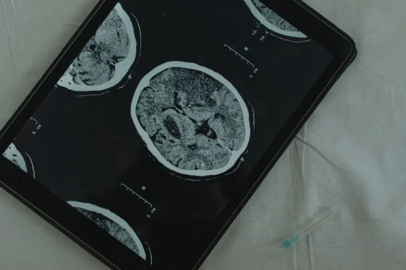 Why Your Brain Loves the Small Score More Than the Big Payday